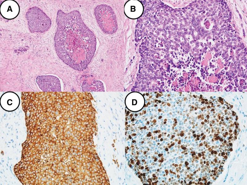 https://cdn.ncbi.nlm.nih.gov/pmc/blobs/0bc7/11441850/0169fe4c2b58/medi-103-e39848-g004.jpg