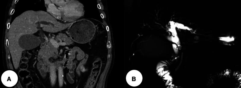 https://cdn.ncbi.nlm.nih.gov/pmc/blobs/0bc7/11441850/fe4dc7546c23/medi-103-e39848-g003.jpg