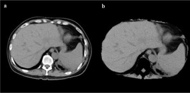 https://cdn.ncbi.nlm.nih.gov/pmc/blobs/0bc7/5225683/7f94210ba9eb/EXCLI-15-500-g-004.jpg