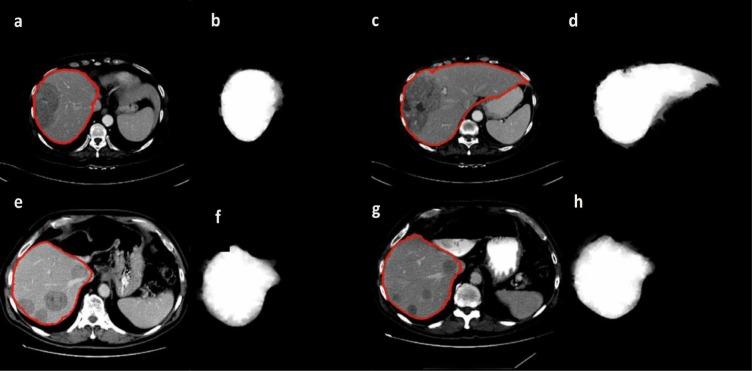 https://cdn.ncbi.nlm.nih.gov/pmc/blobs/0bc7/5225683/8a700f588c9d/EXCLI-15-500-g-005.jpg