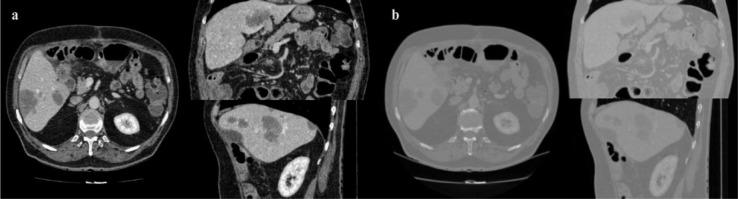 https://cdn.ncbi.nlm.nih.gov/pmc/blobs/0bc7/5225683/cdb2fd3701bf/EXCLI-15-500-g-007.jpg