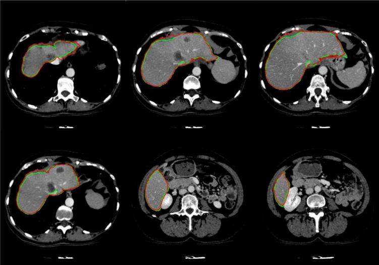 https://cdn.ncbi.nlm.nih.gov/pmc/blobs/0bc7/5225683/ef71780ff1ae/EXCLI-15-500-g-008.jpg