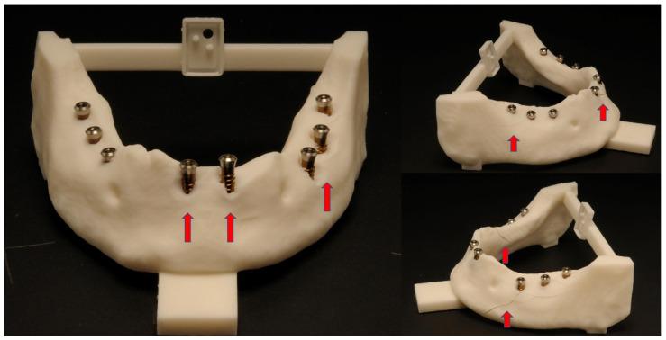 https://cdn.ncbi.nlm.nih.gov/pmc/blobs/0bc8/9600962/4173f605d225/dentistry-10-00187-g007.jpg