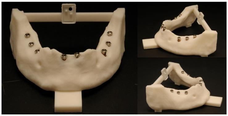 https://cdn.ncbi.nlm.nih.gov/pmc/blobs/0bc8/9600962/548e4f54f3c8/dentistry-10-00187-g008.jpg