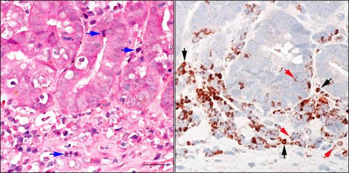 https://cdn.ncbi.nlm.nih.gov/pmc/blobs/0bcc/6271348/bfc0305fc1b6/JVIM-32-1911-g003.jpg