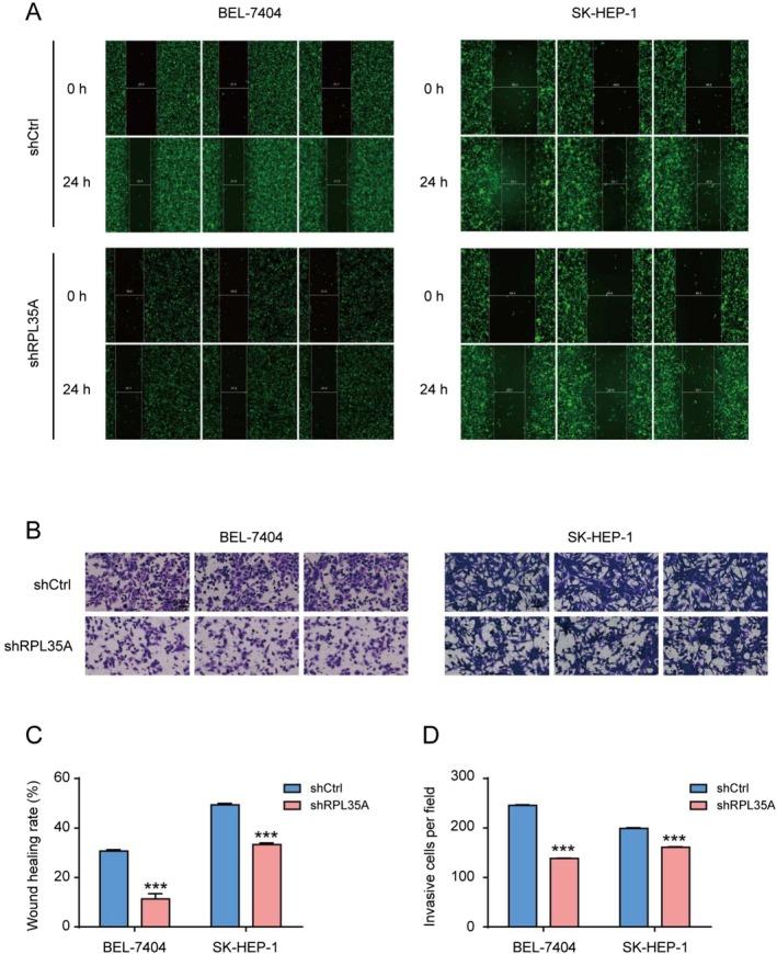 https://cdn.ncbi.nlm.nih.gov/pmc/blobs/0bcf/12185999/10b71baa0f94/CAM4-14-e70985-g004.jpg