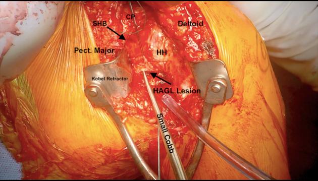 https://cdn.ncbi.nlm.nih.gov/pmc/blobs/0bd7/6305904/dcb85e08567e/gr3.jpg