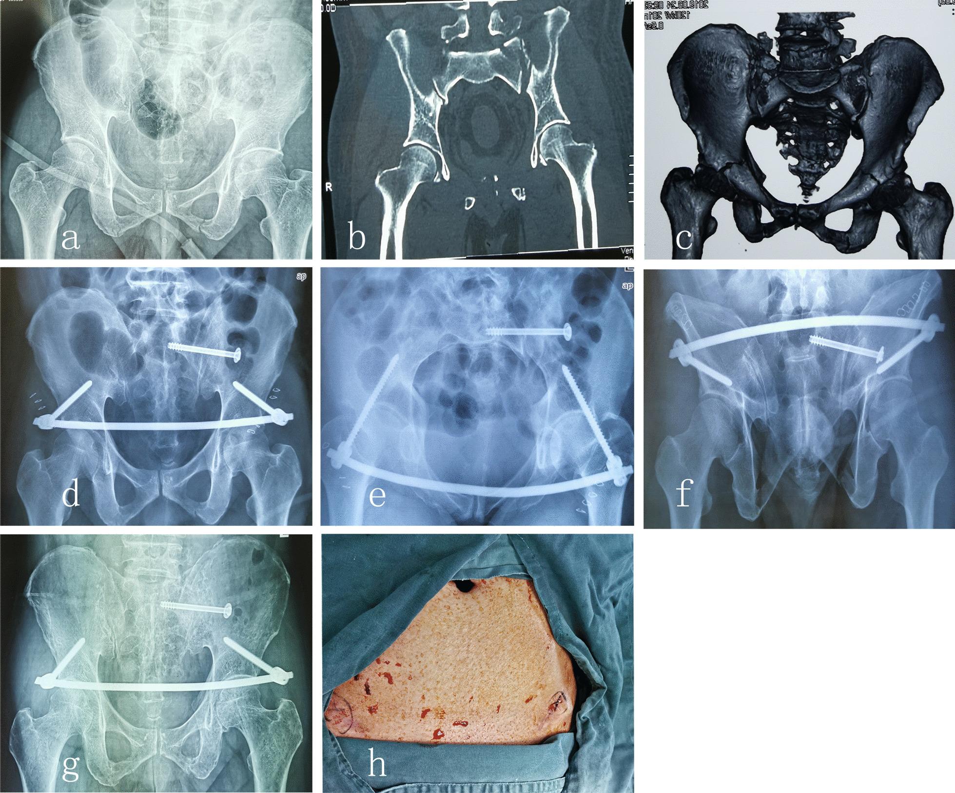 https://cdn.ncbi.nlm.nih.gov/pmc/blobs/0bd7/9124380/8784ef1d3a2c/13018_2022_3133_Fig2_HTML.jpg