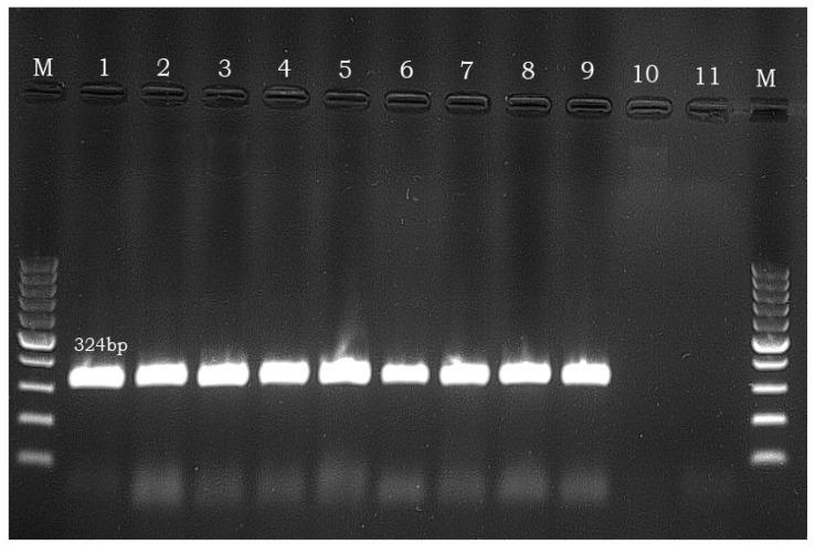 https://cdn.ncbi.nlm.nih.gov/pmc/blobs/0be1/10302148/bf64d50f8781/microorganisms-11-01373-g001.jpg