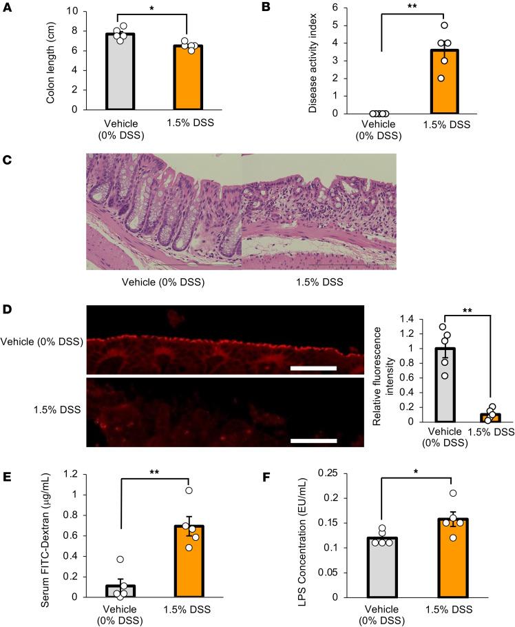 https://cdn.ncbi.nlm.nih.gov/pmc/blobs/0bec/12128978/072942e04462/jciinsight-10-183864-g050.jpg