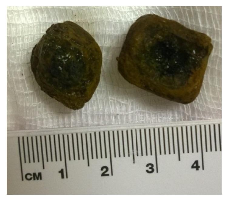 https://cdn.ncbi.nlm.nih.gov/pmc/blobs/0bf1/5516759/2edb7b93fc09/CRIGM2017-6918905.004.jpg