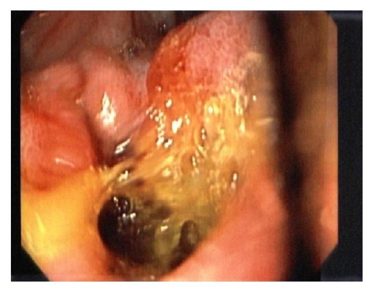 https://cdn.ncbi.nlm.nih.gov/pmc/blobs/0bf1/5516759/96236840b15b/CRIGM2017-6918905.002.jpg
