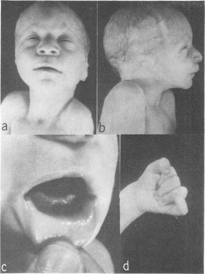 https://cdn.ncbi.nlm.nih.gov/pmc/blobs/0bf5/1013525/8dbf0640b819/jmedgene00303-0035-a.jpg