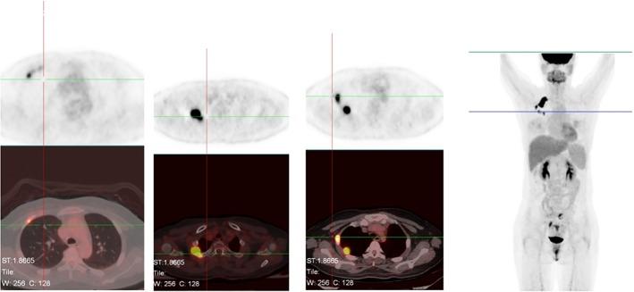 https://cdn.ncbi.nlm.nih.gov/pmc/blobs/0c06/6166076/5de4d56862ff/TCA-9-1327-g003.jpg