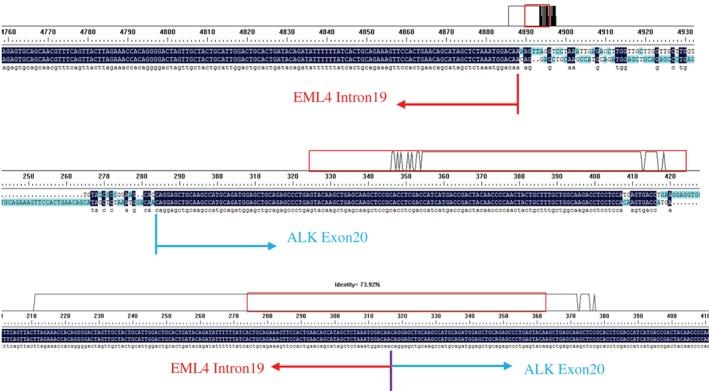 https://cdn.ncbi.nlm.nih.gov/pmc/blobs/0c06/6166076/b91a325f853c/TCA-9-1327-g005.jpg