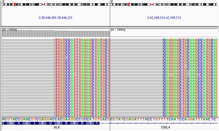 https://cdn.ncbi.nlm.nih.gov/pmc/blobs/0c06/6166076/d6a4f779ebc8/TCA-9-1327-g006.jpg