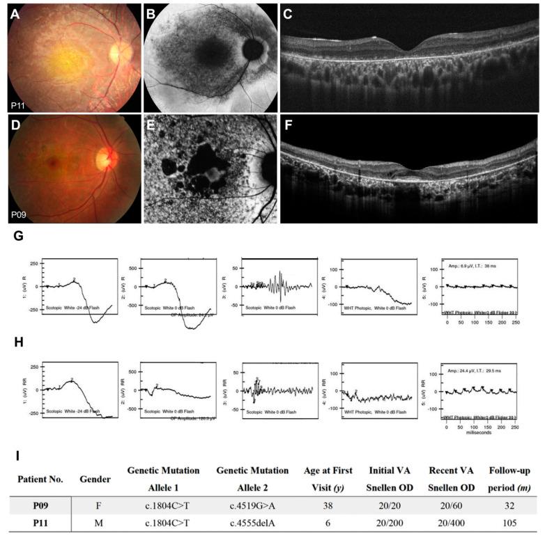 https://cdn.ncbi.nlm.nih.gov/pmc/blobs/0c06/7759801/37e46c4ae174/genes-11-01421-g007.jpg