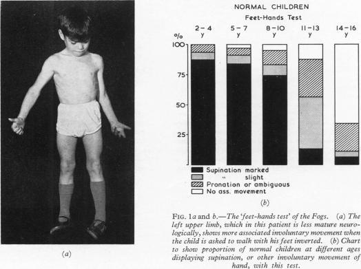 https://cdn.ncbi.nlm.nih.gov/pmc/blobs/0c0d/2019522/93804773c6f2/archdisch01571-0004-a.jpg