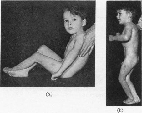 https://cdn.ncbi.nlm.nih.gov/pmc/blobs/0c0d/2019522/ce7772dc21bb/archdisch01571-0013-b.jpg