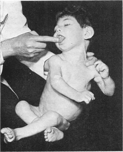 https://cdn.ncbi.nlm.nih.gov/pmc/blobs/0c0d/2019522/ec359df4bfb5/archdisch01571-0010-a.jpg