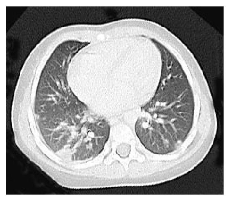 https://cdn.ncbi.nlm.nih.gov/pmc/blobs/0c0d/4706898/c93021278365/CRIPE2015-291025.001.jpg