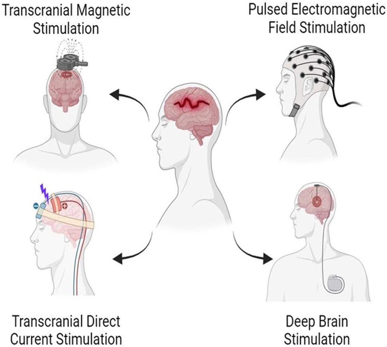 https://cdn.ncbi.nlm.nih.gov/pmc/blobs/0c0e/11687385/7157db8561fc/nihms-2041562-f0001.jpg
