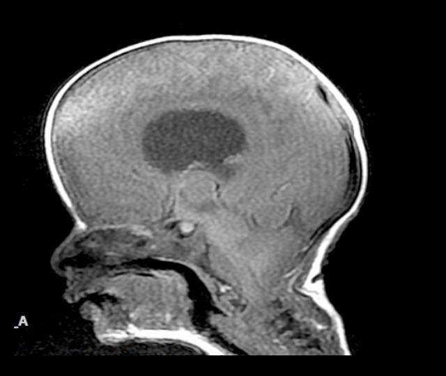 https://cdn.ncbi.nlm.nih.gov/pmc/blobs/0c0f/6537754/8d4b465985ac/amjcaserep-20-719-g002.jpg