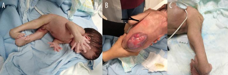 https://cdn.ncbi.nlm.nih.gov/pmc/blobs/0c0f/6537754/b839a8049ab8/amjcaserep-20-719-g001.jpg