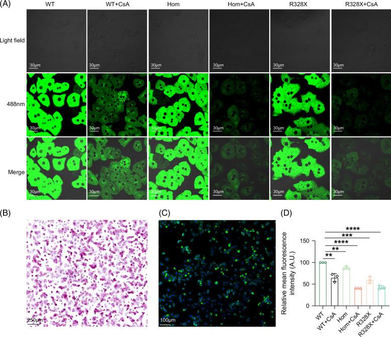 https://cdn.ncbi.nlm.nih.gov/pmc/blobs/0c14/11737122/e2296600da47/hep-81-408-g004.jpg