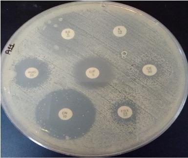 https://cdn.ncbi.nlm.nih.gov/pmc/blobs/0c14/11832270/100492c08a98/JTM2025-8755082.003.jpg
