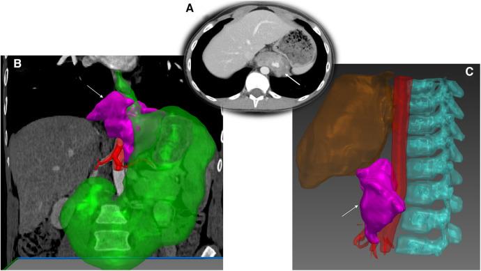 https://cdn.ncbi.nlm.nih.gov/pmc/blobs/0c16/11166126/78bac38350b7/fped-12-1386280-g002.jpg