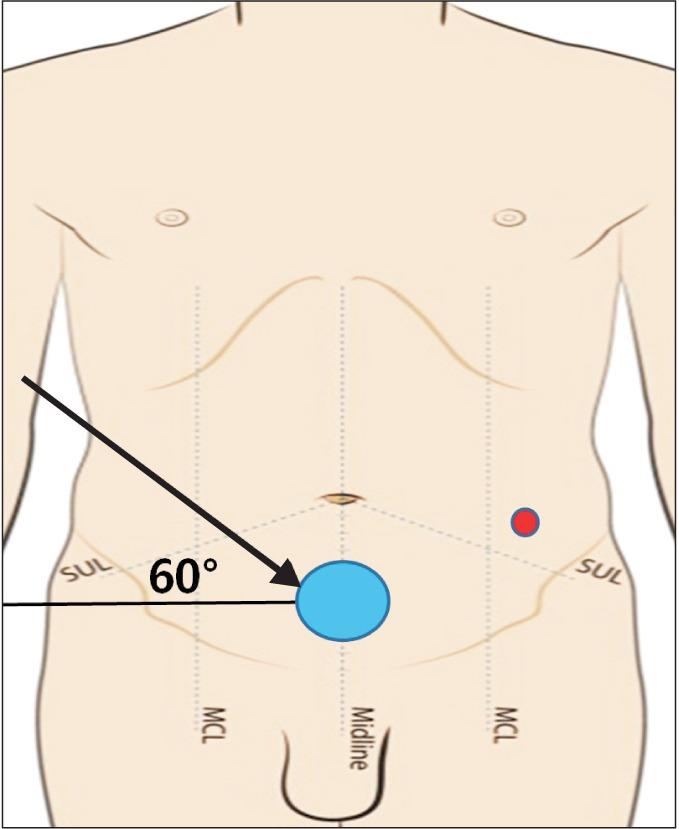 https://cdn.ncbi.nlm.nih.gov/pmc/blobs/0c19/5064233/e50ee3c77423/astr-91-212-g002.jpg