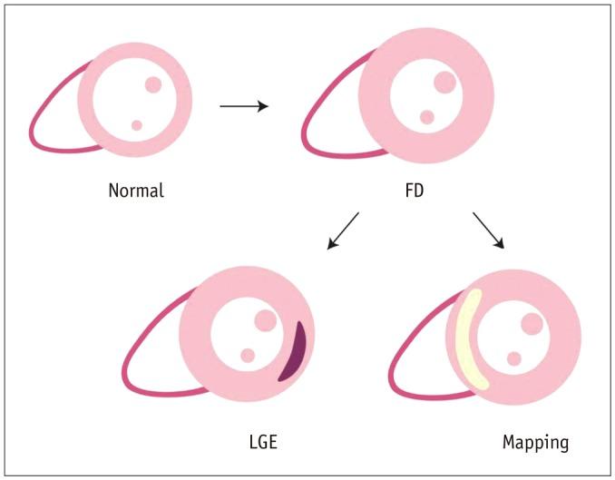 https://cdn.ncbi.nlm.nih.gov/pmc/blobs/0c1c/5240500/0cbfa3e1420e/kjr-18-113-g009.jpg