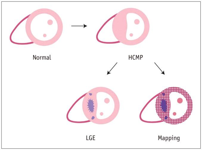 https://cdn.ncbi.nlm.nih.gov/pmc/blobs/0c1c/5240500/3ea152a177b8/kjr-18-113-g008.jpg