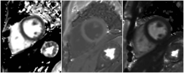https://cdn.ncbi.nlm.nih.gov/pmc/blobs/0c1c/5240500/536efbdf2e8c/kjr-18-113-g001.jpg