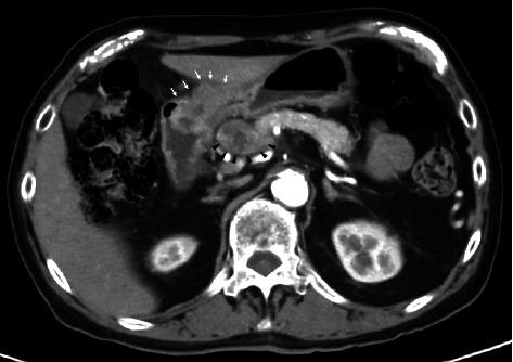 https://cdn.ncbi.nlm.nih.gov/pmc/blobs/0c24/12283206/a51e40512157/CRIGM2025-2752788.003.jpg