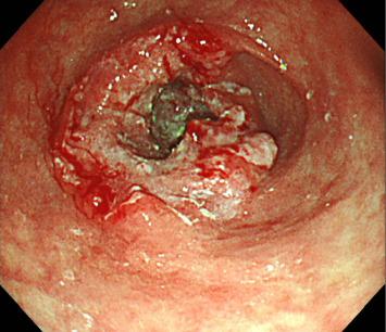 https://cdn.ncbi.nlm.nih.gov/pmc/blobs/0c24/12283206/fee1a0f60537/CRIGM2025-2752788.001.jpg