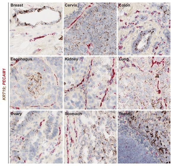https://cdn.ncbi.nlm.nih.gov/pmc/blobs/0c24/5132049/28e67fe8d96a/JCB-117-2201-g005.jpg