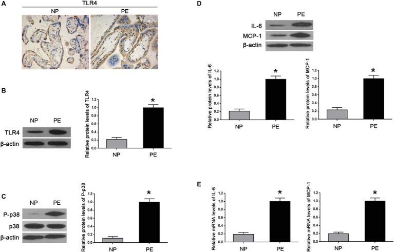https://cdn.ncbi.nlm.nih.gov/pmc/blobs/0c25/6718930/1d3281b7bb49/fphys-10-01030-g001.jpg