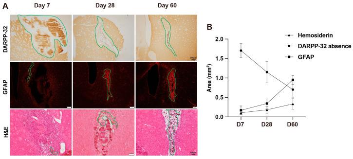 https://cdn.ncbi.nlm.nih.gov/pmc/blobs/0c2f/12346331/ada9a4a614b6/cells-14-01127-g001.jpg