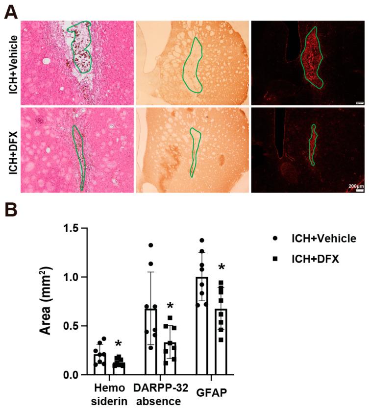 https://cdn.ncbi.nlm.nih.gov/pmc/blobs/0c2f/12346331/de1c43fa244e/cells-14-01127-g003.jpg