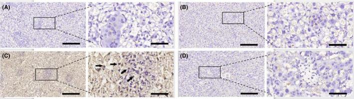 https://cdn.ncbi.nlm.nih.gov/pmc/blobs/0c30/7507205/835a3a89db2d/AJI-84-e13283-g002.jpg