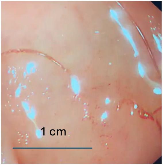 https://cdn.ncbi.nlm.nih.gov/pmc/blobs/0c31/12133547/795b42ef429b/fmed-12-1541099-g001.jpg