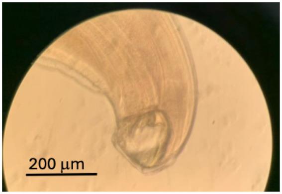 https://cdn.ncbi.nlm.nih.gov/pmc/blobs/0c31/12133547/9f6650d66378/fmed-12-1541099-g002.jpg