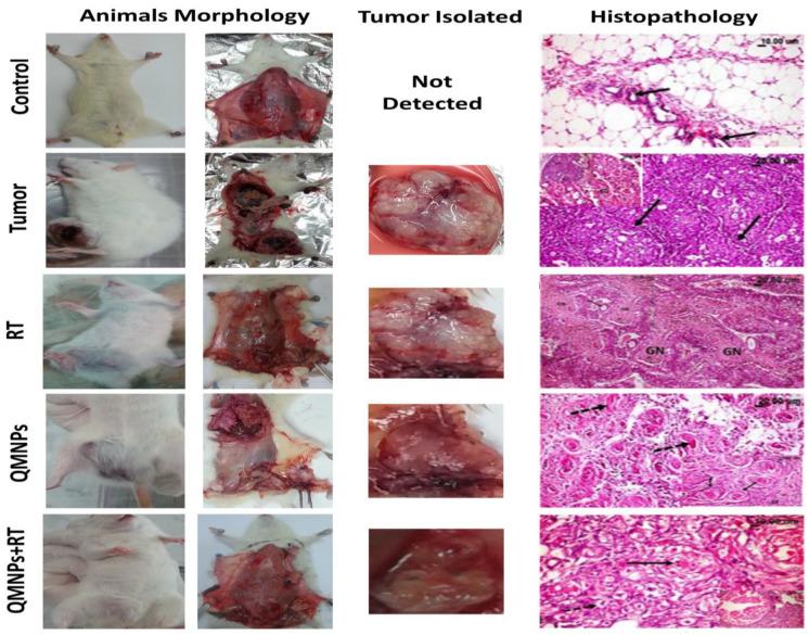 https://cdn.ncbi.nlm.nih.gov/pmc/blobs/0c31/8961357/ba88cbce836e/10.1177_11782234221086728-fig5.jpg