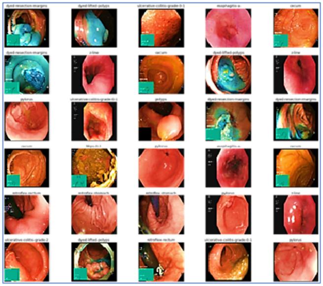 https://cdn.ncbi.nlm.nih.gov/pmc/blobs/0c33/11614869/dadb8e3b7a53/41598_2024_81456_Fig2_HTML.jpg