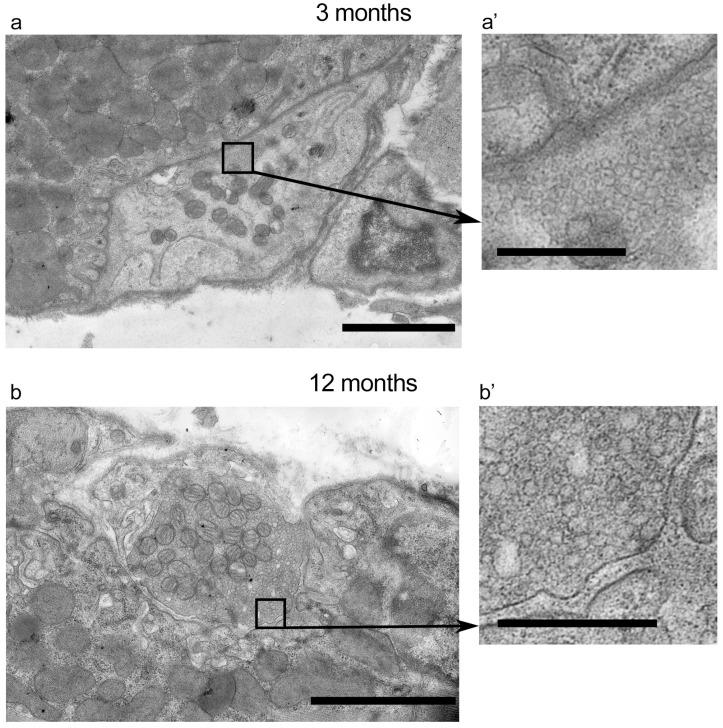 https://cdn.ncbi.nlm.nih.gov/pmc/blobs/0c34/11354816/99448850d6a1/ijms-25-08959-g006.jpg