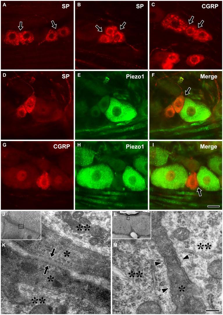 https://cdn.ncbi.nlm.nih.gov/pmc/blobs/0c38/10758013/fac39a16919c/fnana-17-1302373-g005.jpg