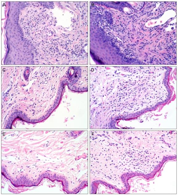 https://cdn.ncbi.nlm.nih.gov/pmc/blobs/0c3e/3060389/54ffd5faa058/kjo-25-121-g003.jpg
