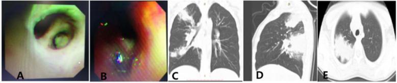 https://cdn.ncbi.nlm.nih.gov/pmc/blobs/0c45/7805118/7eacb70f3925/12879_2021_5765_Fig3_HTML.jpg